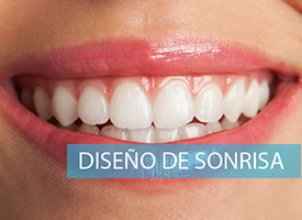 Diseño de Sonrisa Personalizado: Descubre tu Mejor Versión Sonriente.