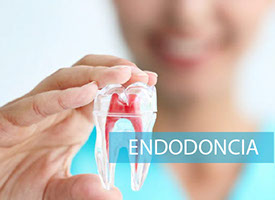 Restaurando con Precisión: Servicios Profesionales de Endodoncia.