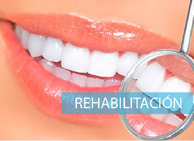 Transformación a través de la Rehabilitación Dental: Sonrisas Renovadas y Funcionalidad Restablecida.